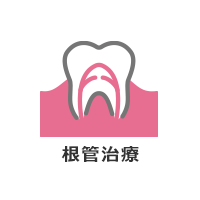 根管治療